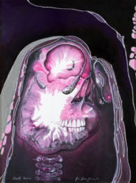 Künstler entwickelte Mischtechnik, 30 x 40 - 2007 -2009